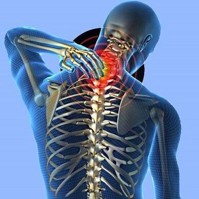 ألم في الرقبة مع عظم العنقي